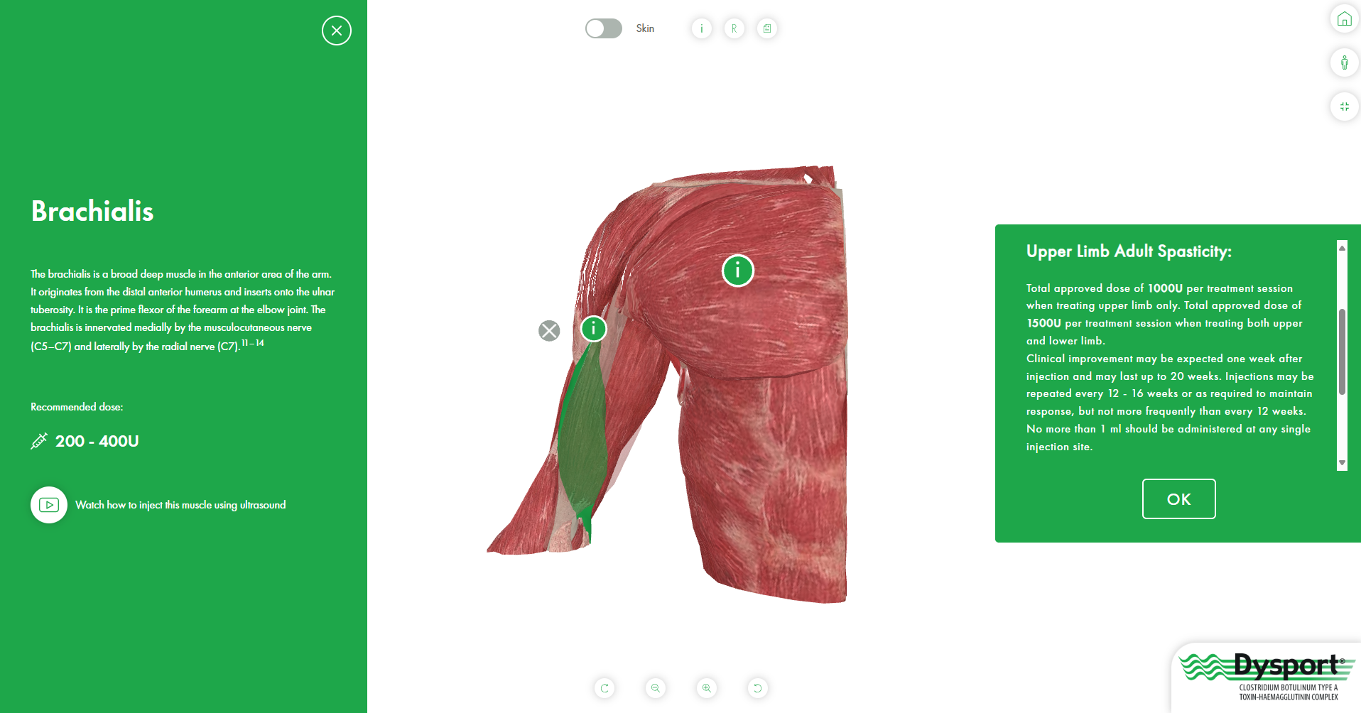Muscle Maps